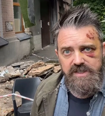 В Подольском районе на американца упал балкон перед входом в подъезд многоквартирного дома - КГВА