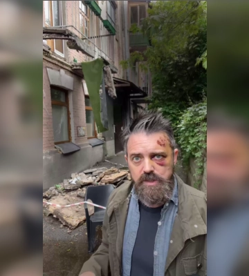 У Києві на режисера із США Крістофера Волтерса, який приїхав документувати війну, впав балкон
