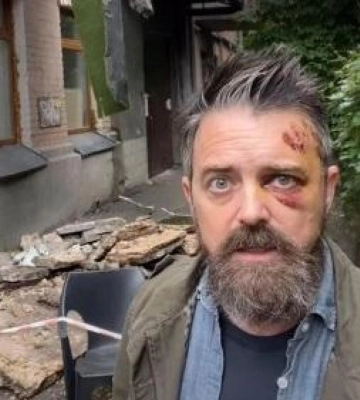 Стало відомо, хто постраждав від падіння балкона в Києві
