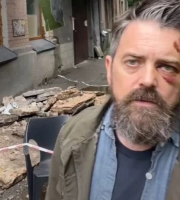 У Києві на американського режисера, який приїхав документувати війну, впав балкон