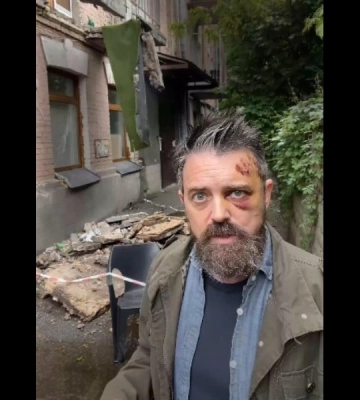 Стало відомо, хто постраждав від падіння балкона в Києві