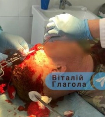 Стрілянина у ромському таборі у Великому Березному: є поранені, серед них дитина