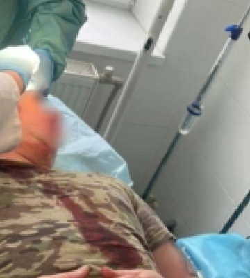 У Великому Березному на Ужгородщині група місцевих жителів напала на прикордонників під час перевірки