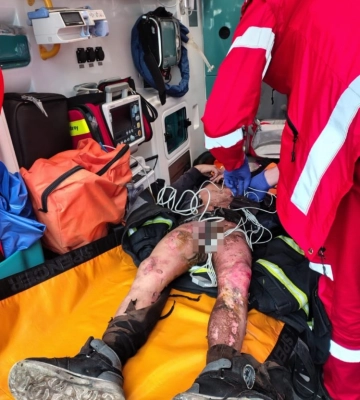 В Одесі підлітка вдарило струмом на даху вагона: хлопця відкинуло під поїзд (ФОТО)