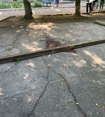 У Кропивницькому на майданчику металева труба впала на 5-річного хлопчика. Він у реанімації