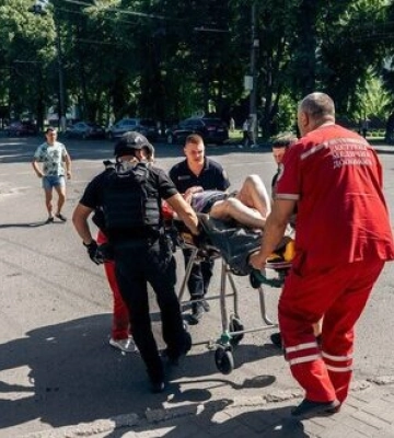 Удар РФ по Сумах: 4 людини у важкому стані, серед них - двоє дітей. ФОТО