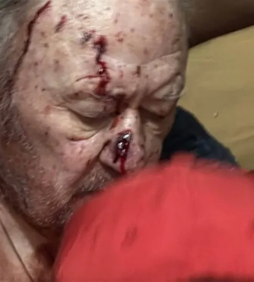 Під час масованої атаки дронів Одеса зазнала значних руйнувань: мерія показала, яких саме
