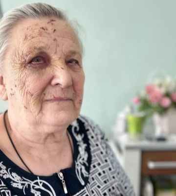 «Я дві війни пережила»: 86-річна лучанка постраждала під час ракетного обстрілу Луцька
