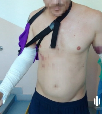 Інструктора підозрюють у побитті військового на полігоні Кіровоградщини 