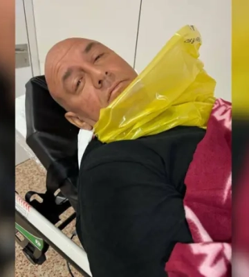«Пауза, швидка, крапельниці»: Потапа госпіталізовано до лікарні