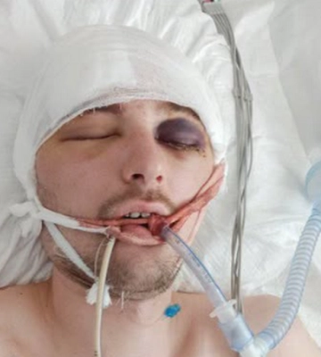 На Львівщині мобілізований вистрибнув із вантажівки дорогою на полігон: чоловік перебуває у комі