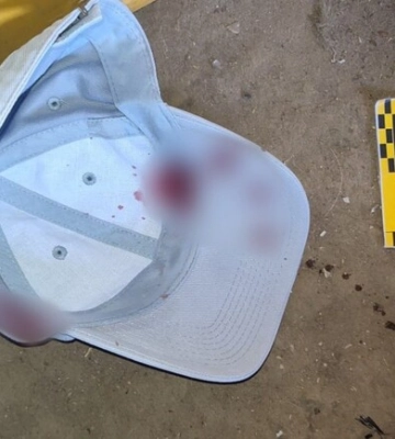 Розбійний напад у Харкові: чоловік жорстоко побив та пограбував працівника пункту металобрухту