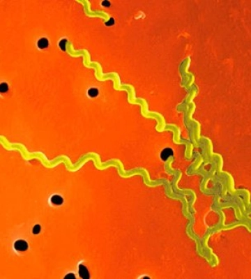 Закарпаття під загрозою: Смертельний лептоспіроз атакує регіон!