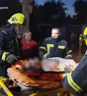 Пожежа у Кривому Розі: дснсники врятували чоловіка