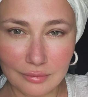Бореліоз мене ледь не вбив, – Олена Мозгова відверто розповіла про серйозну хворобу