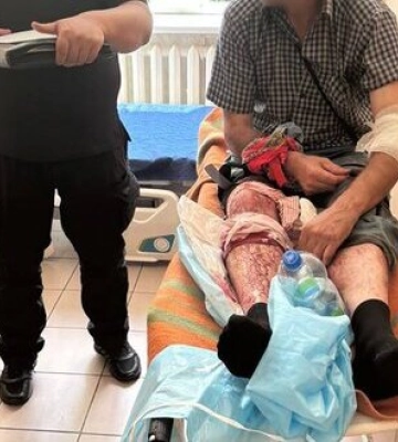 Рашисты сбросили взрывчатку на село в Черниговской области: ранен мужчина. ФОТО