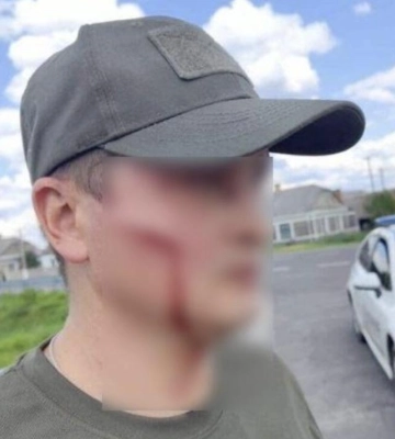На Волині невідомий вдарив лопатою працівника ТЦК