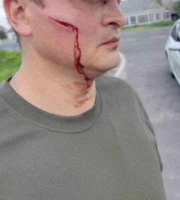 У Ковельському районі невідомий напав на військовослужбовця під час перевірки документів