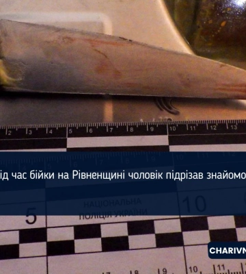 Під час бійки на Рівненщині чоловік підрізав знайомого