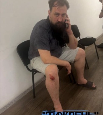СКАНДАЛЬНИЙ БЛОГЕР КОШЕЛЬНИК ВЛАШТУВАВ П’ЯНЕ ДТП В ЦЕНТРІ КИЄВА