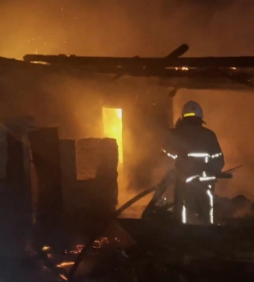У Конотопі на пожежі травмувався чоловік