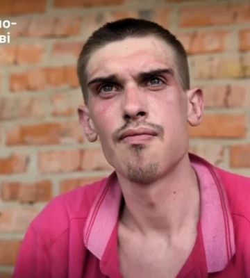Полонений окупант зі зламаною щелепою розповів про жорстокість командування РФ