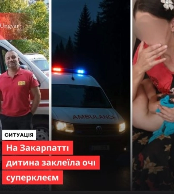 Заклеїв очі суперклеєм: на Закарпатті медики врятували 3-річного хлопчика