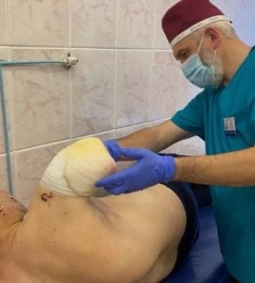 Уламок відрізав руку, понівечив ногу: у Дніпрі врятували чоловіка після важкого поранення