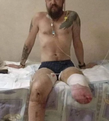 На Одещині воїн-лікар з Ізмаїла потребує допомоги