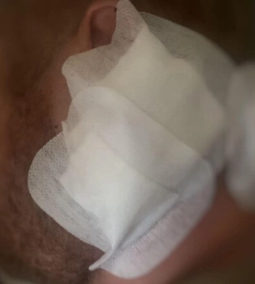Лікарі говорять «Все буде добре»: у Дніпрі врятували бійця, якому снайпер влучив в голову