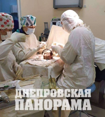 У Дніпрі завдяки унікальній методиці медики врятували руку бійцю, який вже повернувся на фронт