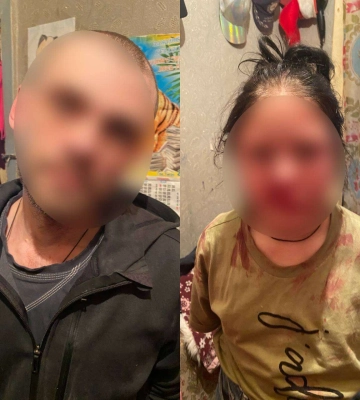В Днепре отчим жестоко избил свою 12-летнюю падчерицу