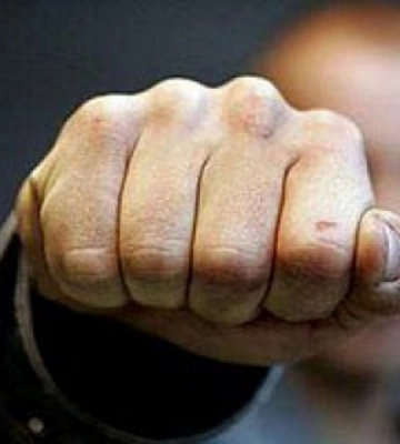 У Дніпрі ревнивець влаштував засідку та побив суперника