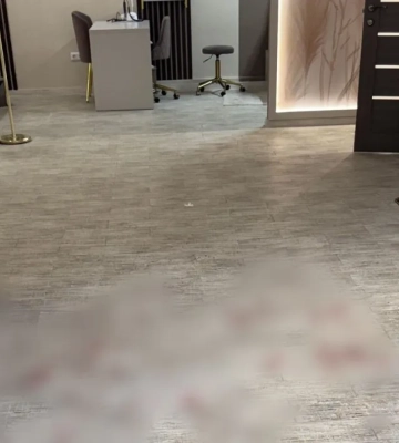 Клієнт салону на Вінниччині напав із ножем через відмову у дешевій стрижці