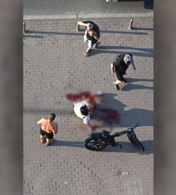 У Києві собака без повідка покусав жінку та її улюбленця