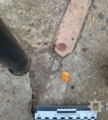 На Дніпропетровщині затримано зловмисника, через якого серйозно травмувався чоловік