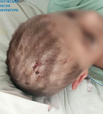 Пять дней ужаса для двоих детей: мужчина пытал малышей