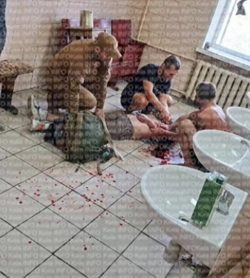 В Киеве мобилизованный порезал себе руки и шею на сборном пункте