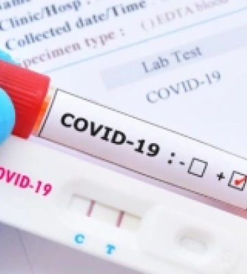 За останній тиждень на Закарпатті зареєстровано 30 нових випадків COVID-19