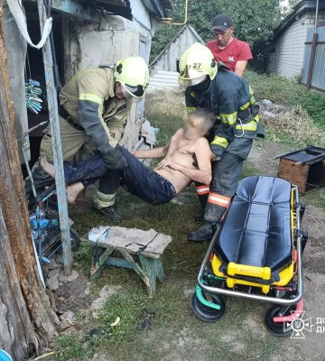 Опіки обличчя та рук: на Дніпропетровщині ледь не згорів чоловік