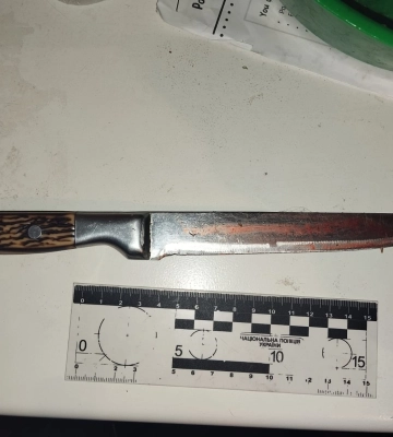 На Волині обрано запобіжний захід 48-річному чоловіку, який кілька разів вдарив друга ножем
