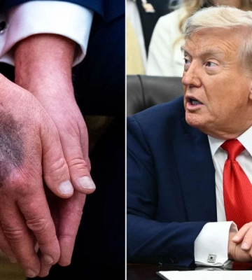 Зникнення Трампа: як тиша породила хвилю чуток про смерть і хвороби. Пояснюємо