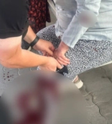 У Луцьку поліцейські врятували жінку з сильною кровотечею