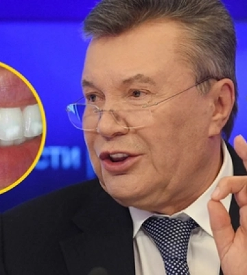 «Зробимо зуби, як у Януковича»: Київ «підірвали» бігборги стоматологічної клініки 