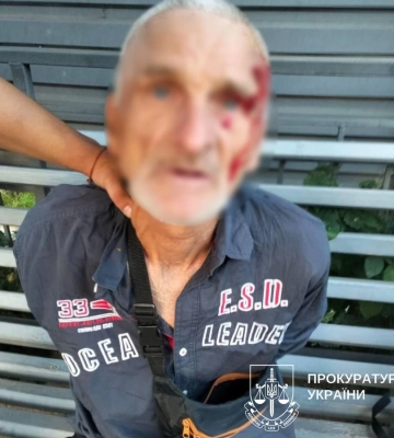 У Києві пограбували 44-річну військову в кав'ярні: вихопили сумку з речами