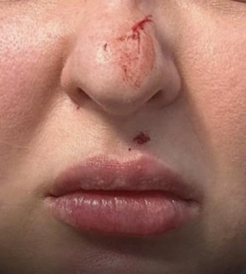 У Львові судять жінку, яка побила дружину військового