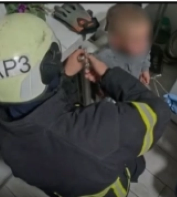 В Луцке спасатели помогли ребенку, рука которого застряла в батарее
