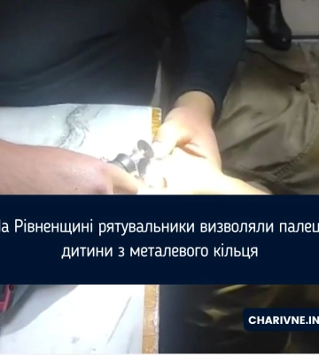 На Рівненщині рятувальники визволяли палець дитини з металевого кільця