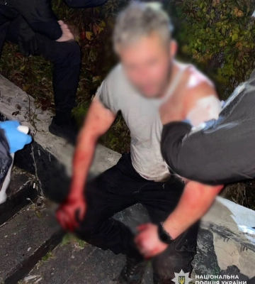 У Києві чоловік зарізав перехожого після суперечки на Замковій горі (ФОТО)