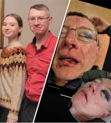 Жестокое задержание в парке Киева: отец получил перелом глазницы и кровоизлияние в мозг